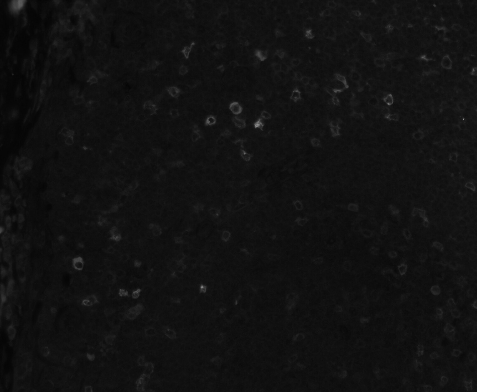 Human OX40/TNFRSF4 Antibody AF3388